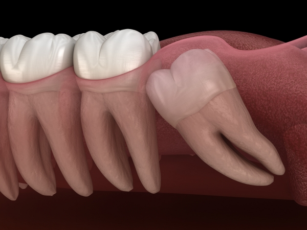 treatments-thumb